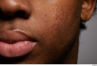 HD Face Skin Canaan-Allvince Epps cheek face lips mouth skin…